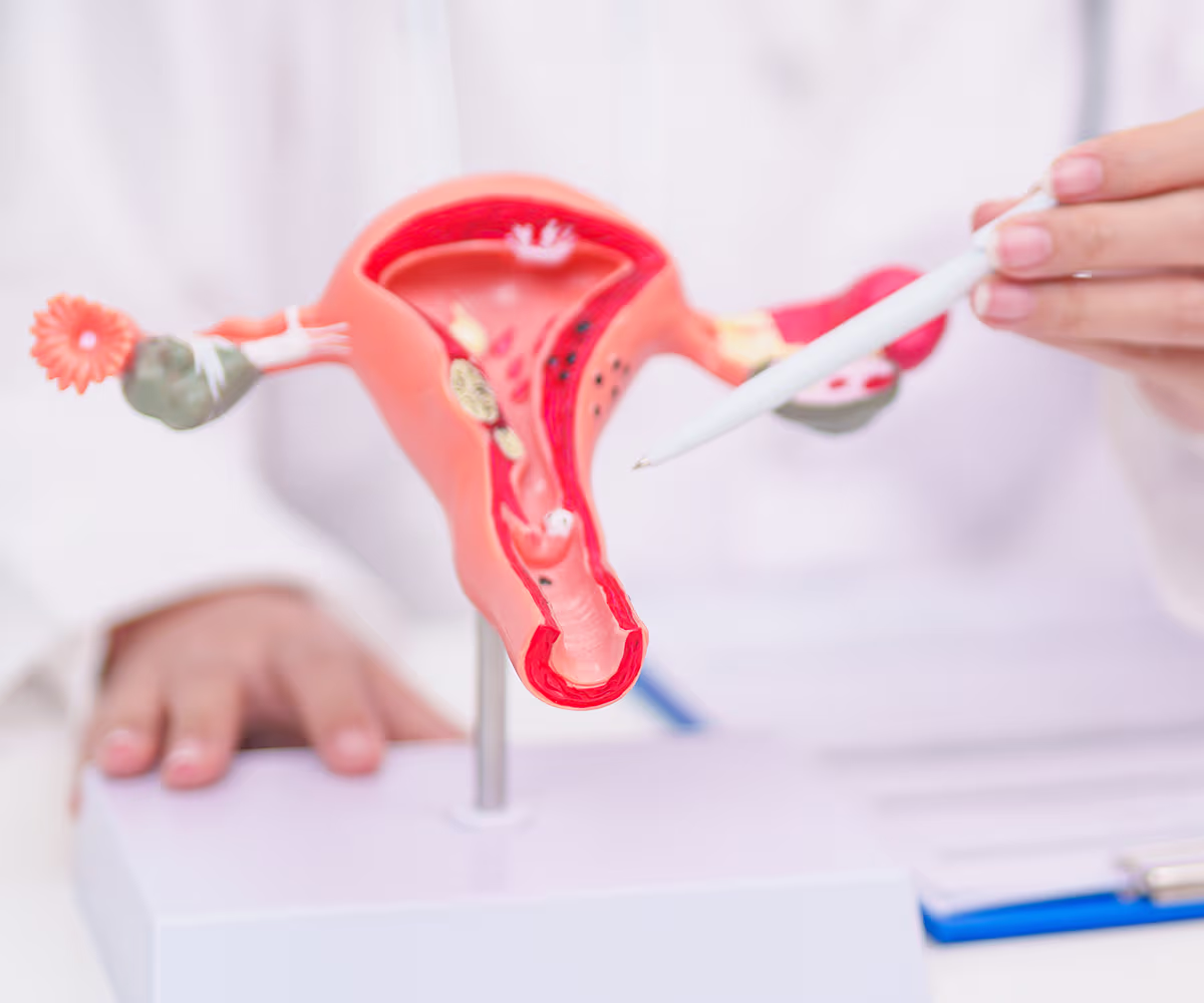 Hysterectomy Accent image showing a doctor using a model of a uterus to explain the procedure to a patient