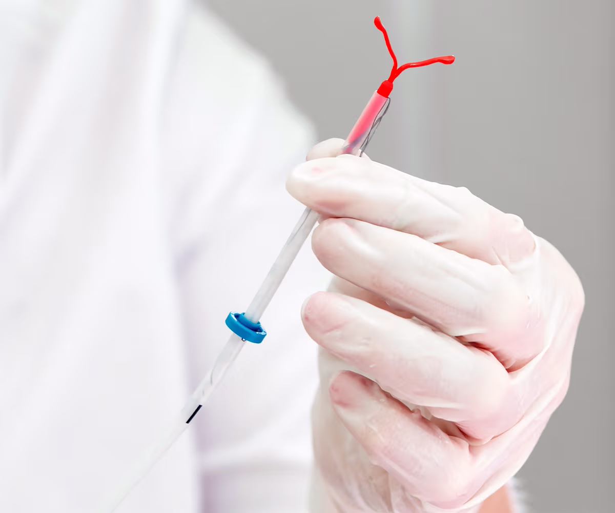 Intrauterine Device (IUD) Accent image showing a doctor holding an IUD